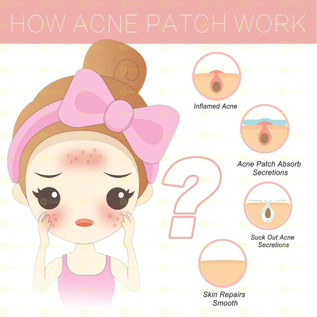 Acne Patch