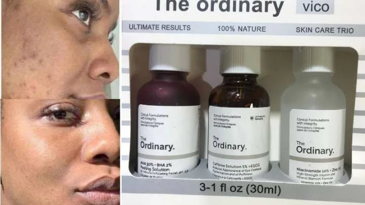 3 in 1 The Ordinary