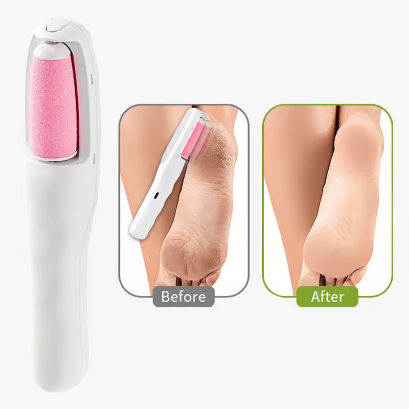 የተረከዝ ሞረድ እና የፀጉር ማንሻ