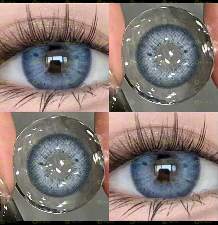 Eye Lens