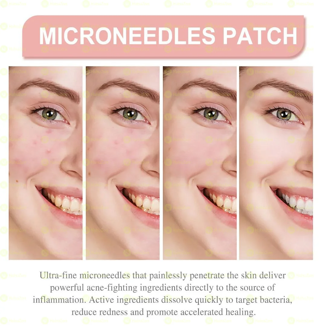 Acne Patch