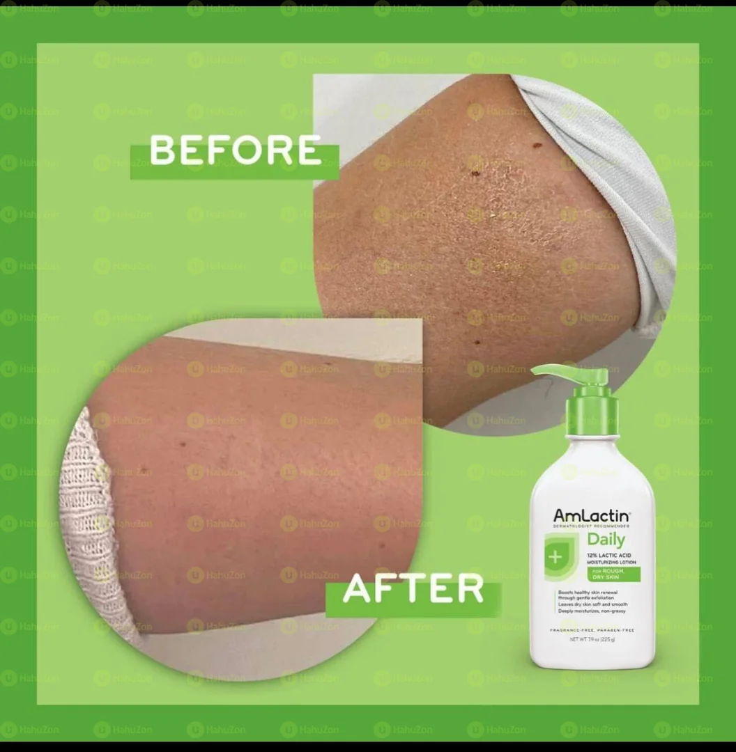 AmLactin Daily Nourish 12%