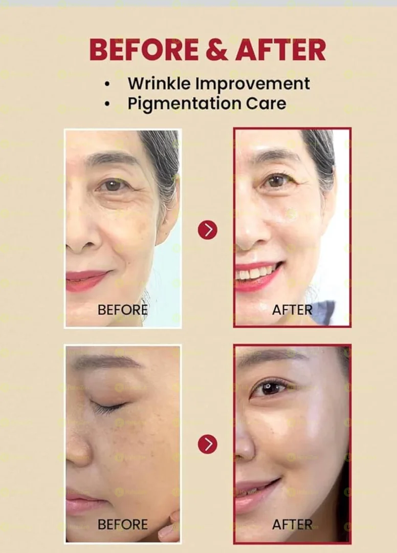 SEOUL 1988 Serum Retinal Liposome 2% + Black Gingeng, 3