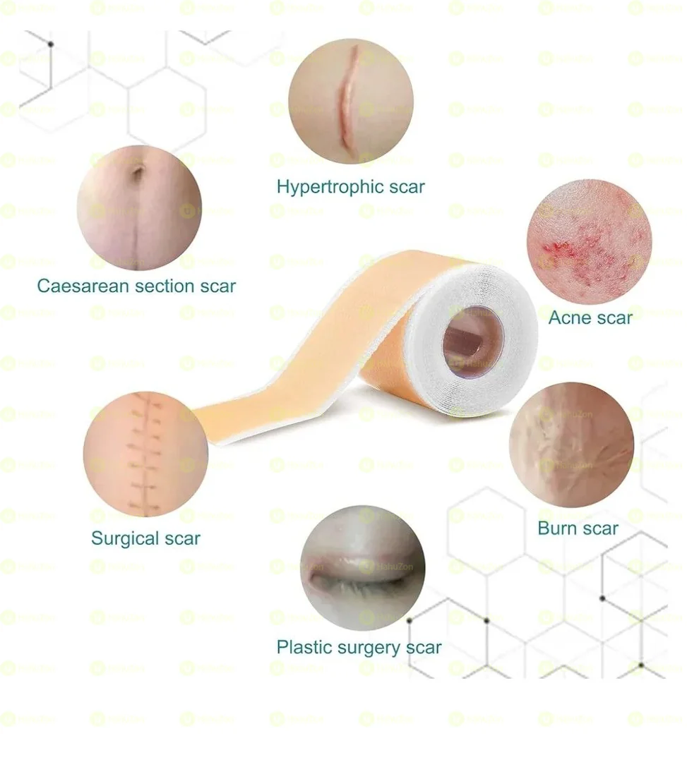 Elaimei Silicone Scar Sheets