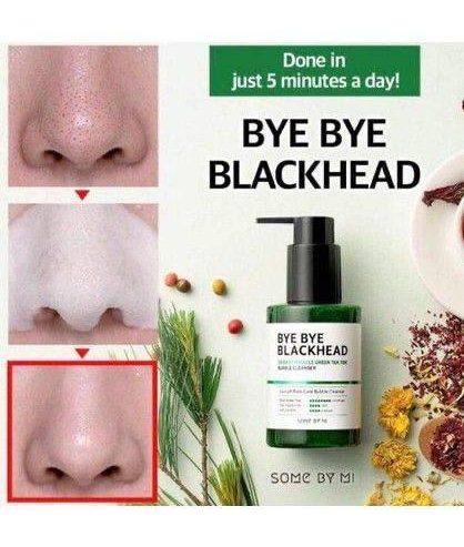 The Some By Mi Bye Bye Blackhead